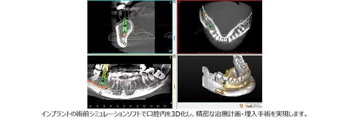 dental_8.png